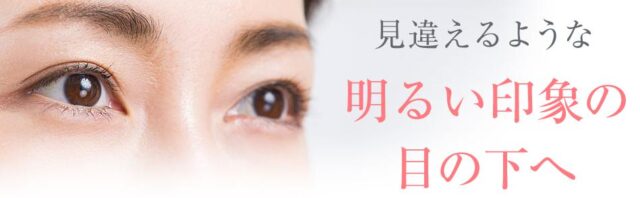 アイキララII 販売店 価格 最安値