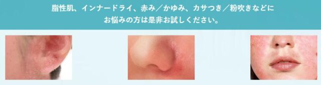 カダソン 洗顔フォーム セラミド化粧水 販売店 価格 最安値