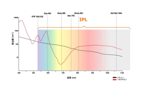 ステラM22 IPL