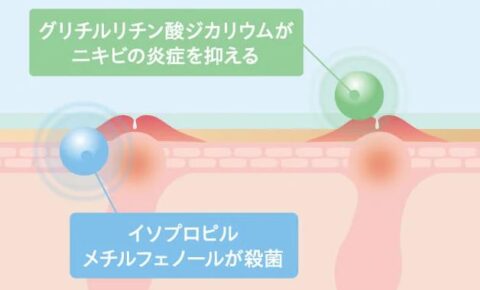 有効成分 ニキビケア
