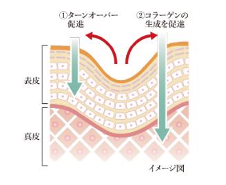 シワ