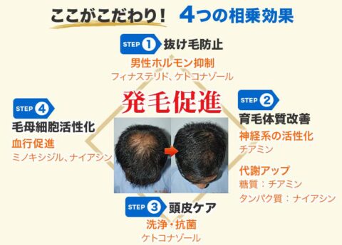 育毛セット