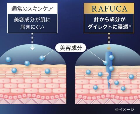マイクロニードル