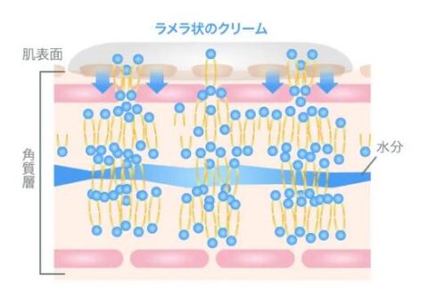 OLT オーソ・ラメラ・テクノロジー 製法