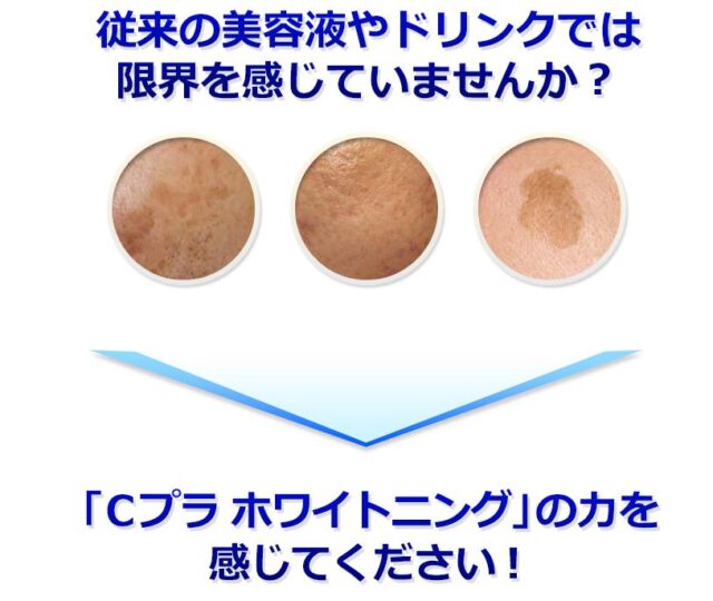 メディユース薬用Cプラホワイトニング 販売店 価格 最安値