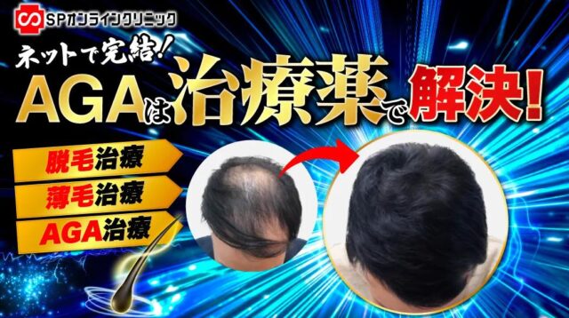 SPオンラインクリニック AGA治療 特徴