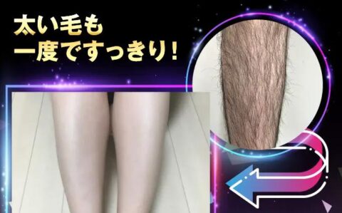 除毛