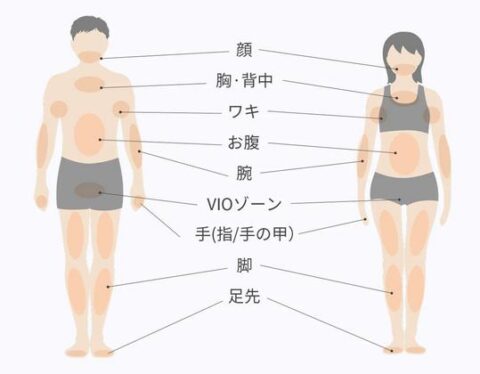 全身脱毛