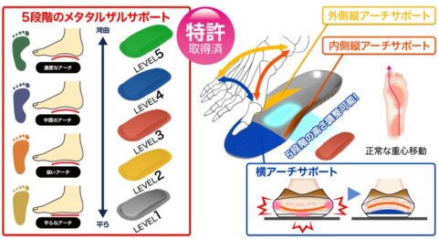 足アーチ補正