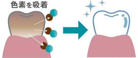 ホワイトニング成分