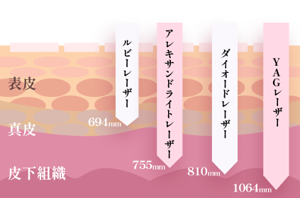 レーザー波長