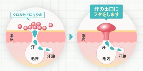 クロルヒドロキシアルミニウム