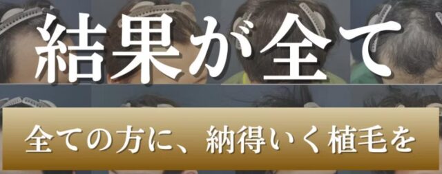 アルモ形成クリニック 自毛植毛 特徴