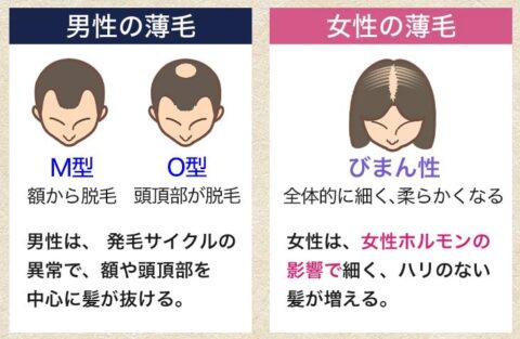 女性 育毛剤