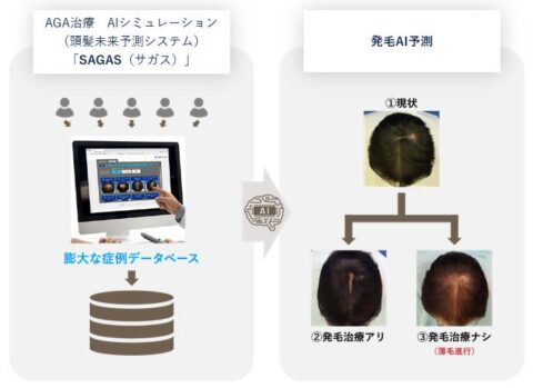 AI パーソナル治療