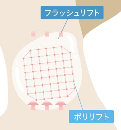 形状記憶ジェリー