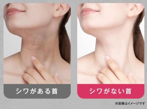 ナイアシンアミド