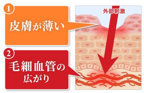 赤ら顔 美容成分 保湿成分