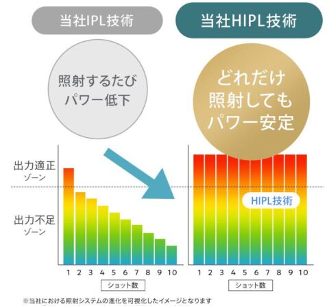 HIPL方式 光脱毛